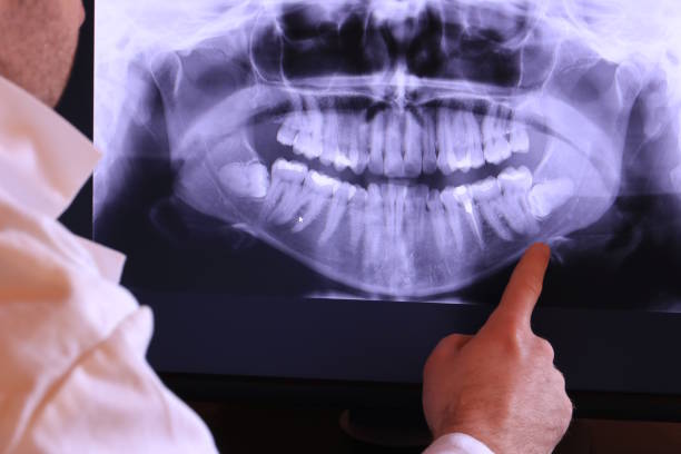 Best Urgent Care for Lost Fillings or Crowns in Bensley, VA